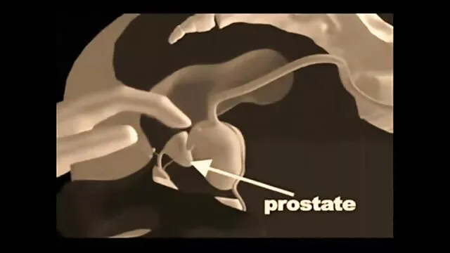 大奶-三重泵治疗-Piccola简 奶奶性的照片